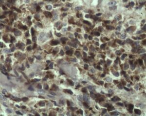Inmunohistoquímica